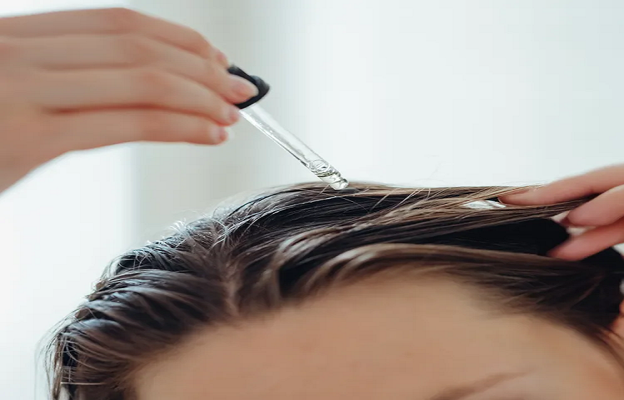 The Ultimate Anti-Dandruff Solution To Solve Your Dandruff Woes